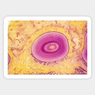 Tooth, light micrograph (P486/0099) Sticker